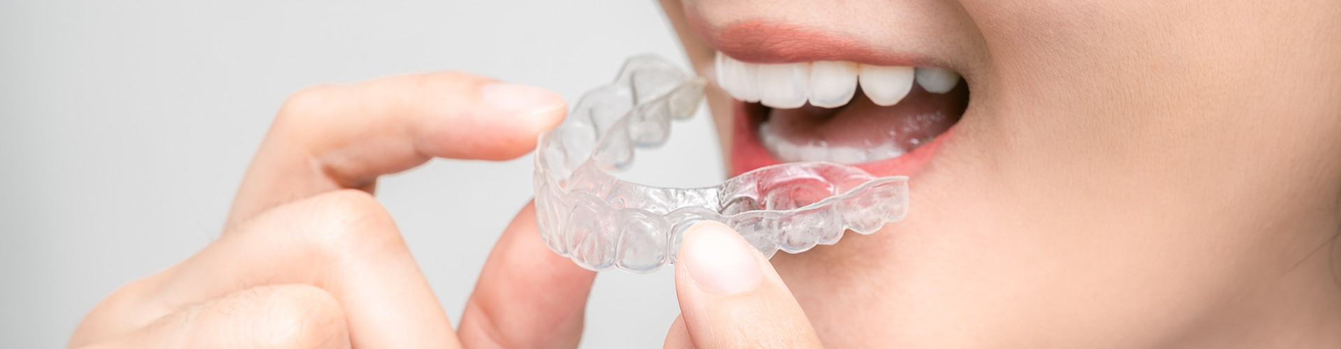 woman placing clear aligner in mouth